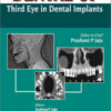 Dental CT: Third Eye in Dental Implants Dental CT Third Eye in Dental Implants