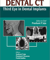 Dental CT Third Eye in Dental Implants