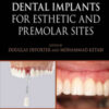 Immediate Dental Implants for Esthetic and Premolar Sites Immediate Dental Implants for Esthetic and Premolar Sites