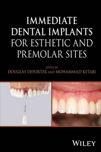 Immediate Dental Implants for Esthetic and Premolar Sites