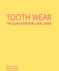 Tooth Wear The Quintessential Challenge