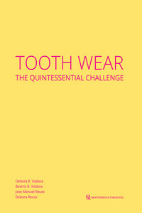 Tooth Wear The Quintessential Challenge