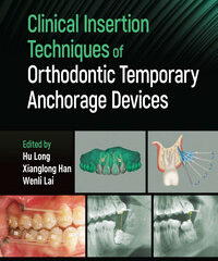 Clinical Insertion Techniques of Orthodontic Temporary Anchorage Devices