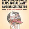 Local and Regional Flaps in Oral Cavity Cancer Reconstruction: A Case-Based Approach Local and Regional Flaps in Oral Cavity Cancer Reconstruction: A Case-Based Approach