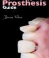 Implant-Supported Prosthesis Guide Implant-Supported Prosthesis Guide