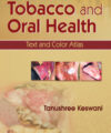 Tobacco and Oral Health: Text and Color Atlas Tobacco and Oral Health: Text and Color Atlas