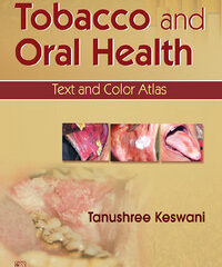 Tobacco and Oral Health: Text and Color Atlas
