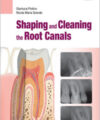 Shaping and Cleaning the Root Canals