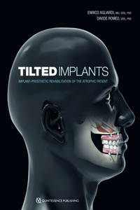Tilted Implants: Implant-Prosthetic Rehabilitation of the Atrophic Patient